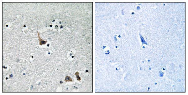 Immunohistochemistry analysis of paraffin-embedded human brain tissue, using ATP6V1H Antibody