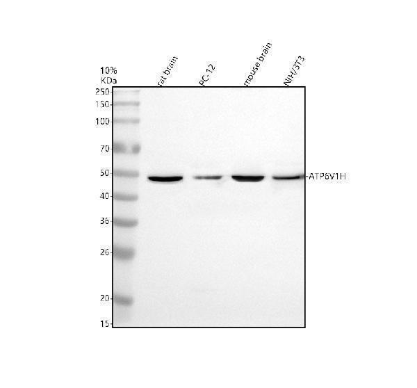 Western blot analysis of ATP6V1H using anti-ATP6V1H antibody (A11008-3)