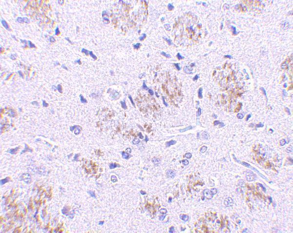 a11010 1 klhl1 primary antibodies ihc testing 2