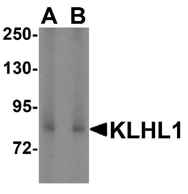 a11010 1 klhl1 primary antibodies wb testing 1