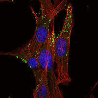 Immunofluorescence analysis of NIH/3T3 cells using KLHL1 Monoclonal Antibody (green)