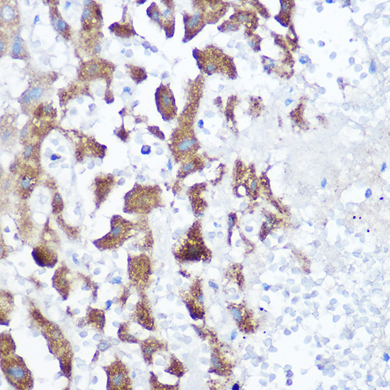 Immunohistochemistry of paraffin-embedded human liver using [KO Validated] NDUFB4 Rabbit pAb  at dilution of 1:150 