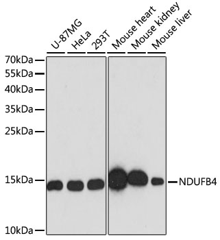 Western blot analysis of extracts of various cell lines, using NDUFB4 antibody  at 1:3000 dilution