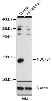 Western blot analysis of extracts from normal  and NDUFB4 knockout  HeLa cells, using NDUFB4 antibody  at 1:1000 dilution