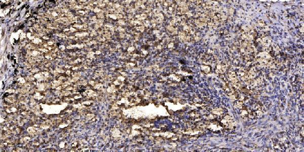 a11018 rab20 primary antibodies ihc testing 1