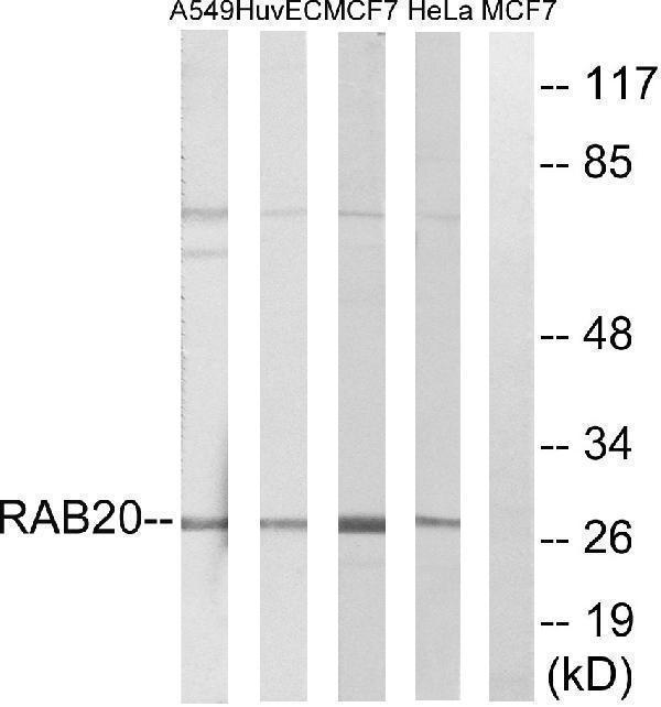 Western blot analysis of lysates from HeLa, MCF-7, HUVEC, and A549 cells, using RAB20 Antibody