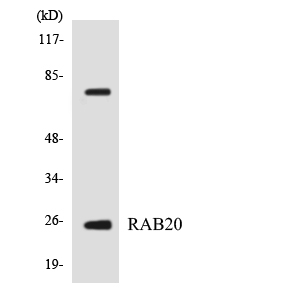 Western blot analysis of the lysates from HeLa cells using RAB20 antibody