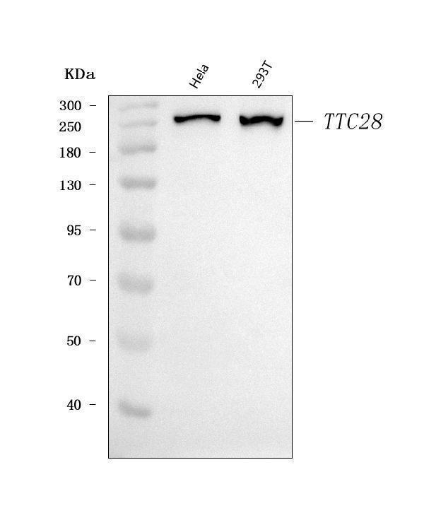 a11024 ttc28 primary antibodies wb testing 1