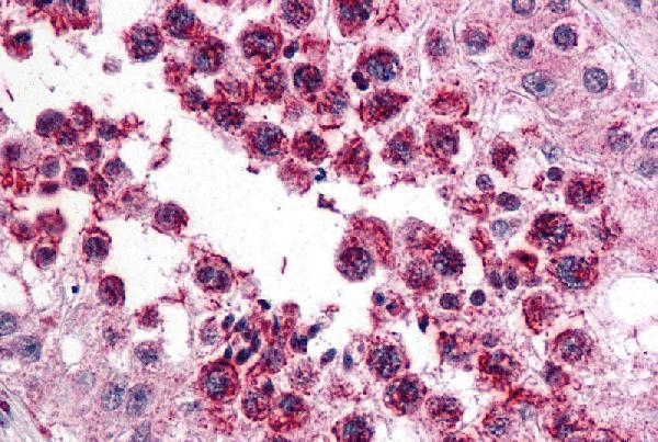 a11030 slain2 primary antibodies ihc testing 1