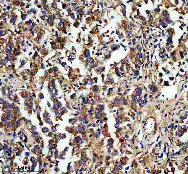 IHC analysis of EXOC5 using anti-EXOC5 antibody (A11035-1)