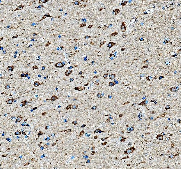 IHC analysis of EXOC5 using anti-EXOC5 antibody (A11035-1)