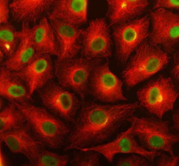 IF analysis of TSR1 using anti-TSR1 antibody (A11043-1) and anti-Alpha Tubulin antibody (M03989-3)