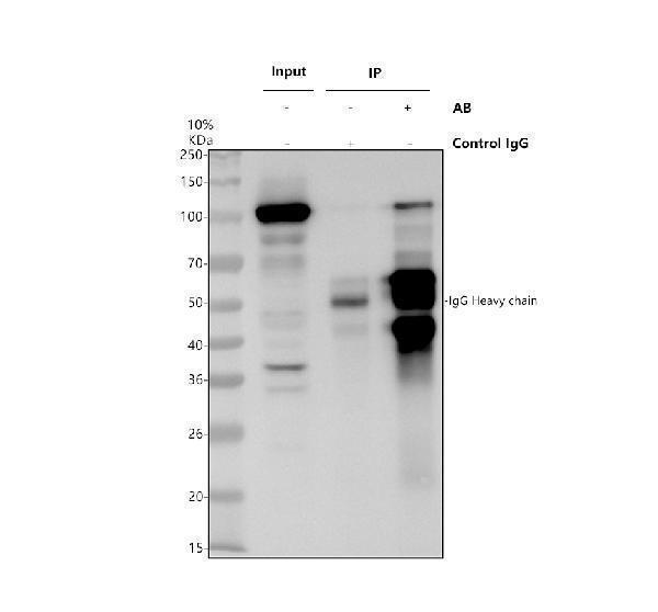 Immunoprecipitating TSR1 in Hela whole cell lysate