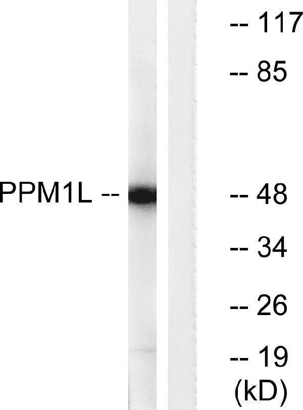 Western blot analysis of lysates from Jurkat cells, using PPM1L Antibody