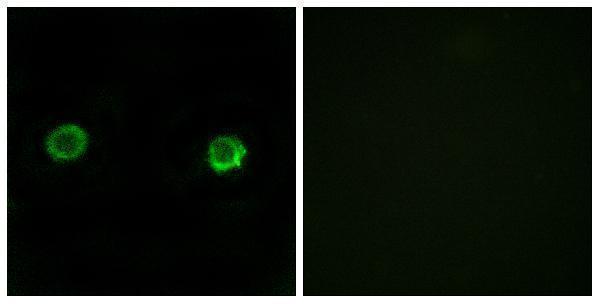 Immunofluorescence analysis of MCF-7 cells, using ABHD2 Antibody