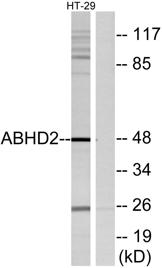 Western blot analysis of lysates from HT29 cells, using ABHD2 Antibody