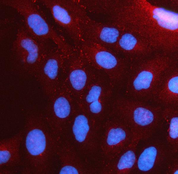 Figure 2. IF analysis of PSTPIP2 using anti-PSTPIP2 antibody (A11056-1). PSTPIP2 was detected in an immunocytochemical section of U2OS cells. Enzyme antigen retrieval was performed using IHC enzyme antigen retrieval reagent (AR0022) for 15 mins. The cells were blocked with 10% goat serum. And then incubated with 5 microg/mL rabbit anti-PSTPIP2 Antibody (A11056-1) overnight at 4°C. Cy3 Conjugated Goat Anti-Rabbit IgG (BA1032) was used as secondary antibody at 1:500 dilution and incubated for 30 minutes at 37°C. The section was counterstained with DAPI. Visualize using a fluorescence microscope and filter sets appropriate for the label used.