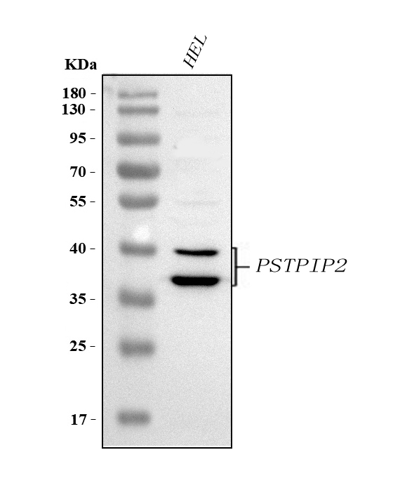 Figure 1. Western blot analysis of PSTPIP2 using anti-PSTPIP2 antibody (A16132-1). Electrophoresis was performed on a 5-20% SDS-PAGE gel at 70V (Stacking gel) / 90V (Resolving gel) for 2-3 hours. The sample well of each lane was loaded with 30 ug of sample under reducing conditions. Lane 1: human HEL whole cell lysates. After electrophoresis, proteins were transferred to a nitrocellulose membrane at 150 mA for 50-90 minutes. Blocked the membrane with 5% non-fat milk/TBS for 1.5 hour at RT. The membrane was incubated with rabbit anti-PSTPIP2 antigen affinity purified polyclonal antibody (Catalog # A16132-1) at 0.5 microg/mL overnight at 4°C, then washed with TBS-0.1%Tween 3 times with 5 minutes each and probed with a goat anti-rabbit IgG-HRP secondary antibody at a dilution of 1:5000 for 1.5 hour at RT. The signal is developed using an Enhanced Chemiluminescent detection (ECL) kit (Catalog # EK1002) with Tanon 5200 system. A specific band was detected for PSTPIP2 at approximately 36,39 kDa. The expected band size for PSTPIP2 is at 36,39 kDa.