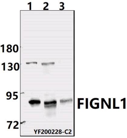 Western blot (WB) analysis of FIGNL1  pAb at 1:1000 dilution
Lane1:PC3  whole cell lysate(40ug)
Lane2:A2780 whole cell lysate(40ug)
Lane3:U-87MG whole cell lysate(40ug)