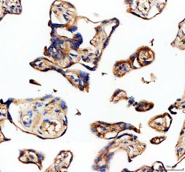 IHC analysis of EPS8L2 using anti-EPS8L2 antibody (A11064-3)