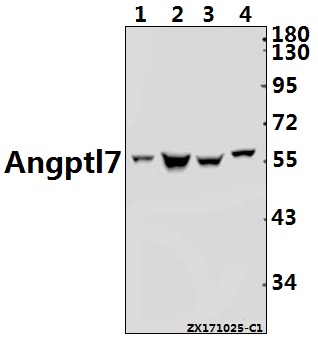 Western blot (WB) analysis of Angptl7 (P346) pAb at 1:1000 dilution
Lane1:H9C2 whole cell lysate(40ug)
Lane2:CT26 whole cell lysate(40ug)
Lane3:Hela whole cell lysate(40ug)
Lane4:MCF-7 whole cell lysate(20ug)