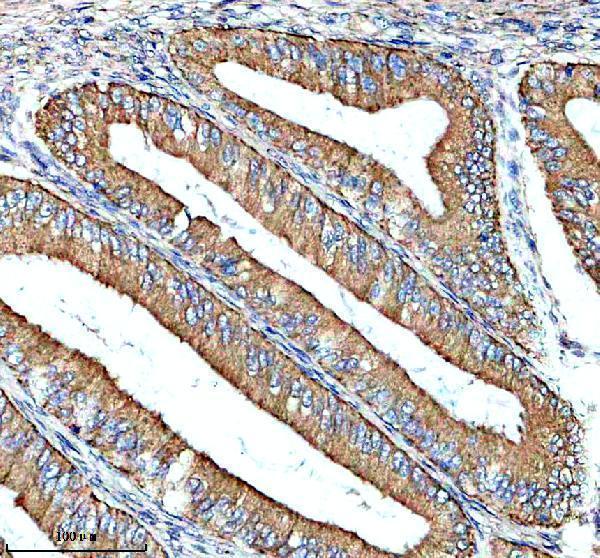 a11069 1 fkbp7 primary antibodies ihc testing 1