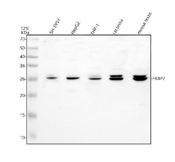 a11069 1 fkbp7 primary antibodies wb testing 1