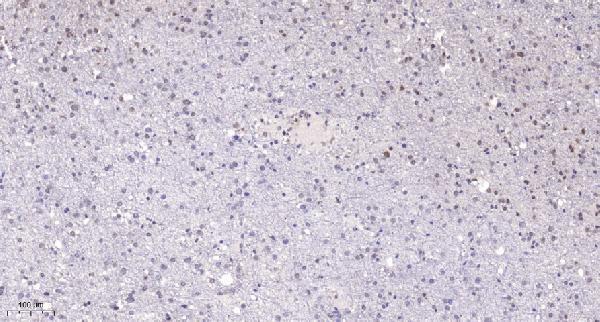 Immunohistochemical analysis of paraffin-embedded human brain