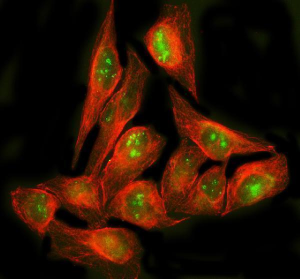  IF analysis of POLR1E using anti-POLR1E antibody (A11077-2) and anti-Beta Tubulin antibody (M01857-3)