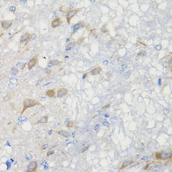 Immunohistochemistry of paraffin-embedded human stomach using CHIC2 antibody  at dilution of 1:100 