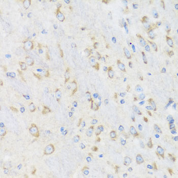 Immunohistochemistry of paraffin-embedded rat brain using CHIC2 antibody  at dilution of 1:100 