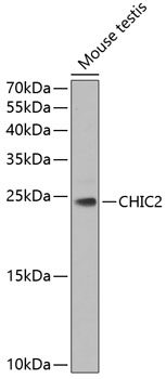 Western blot analysis of extracts of mouse testis, using CHIC2 Antibody  at 1:1000 dilution