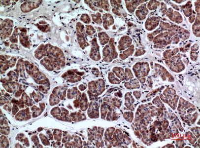 Immunohistochemical analysis of paraffin-embedded human-pancreas, antibody was diluted at 1:100