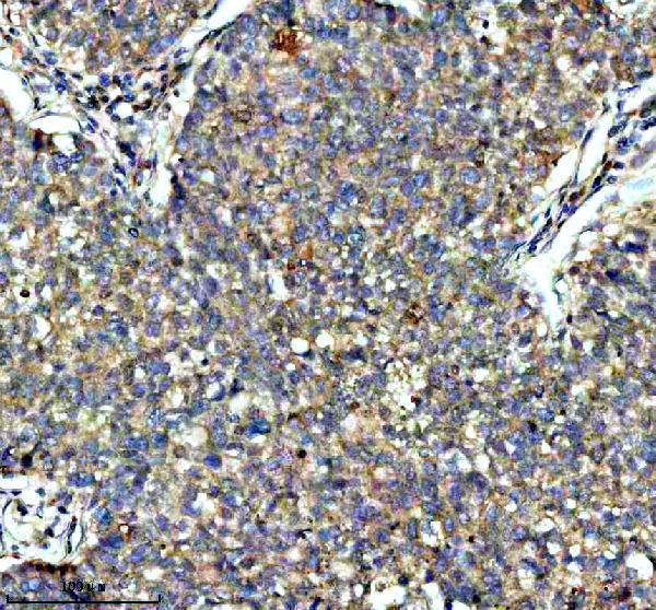IHC analysis of KCNA6 using anti-KCNA6 antibody (A11084-1)