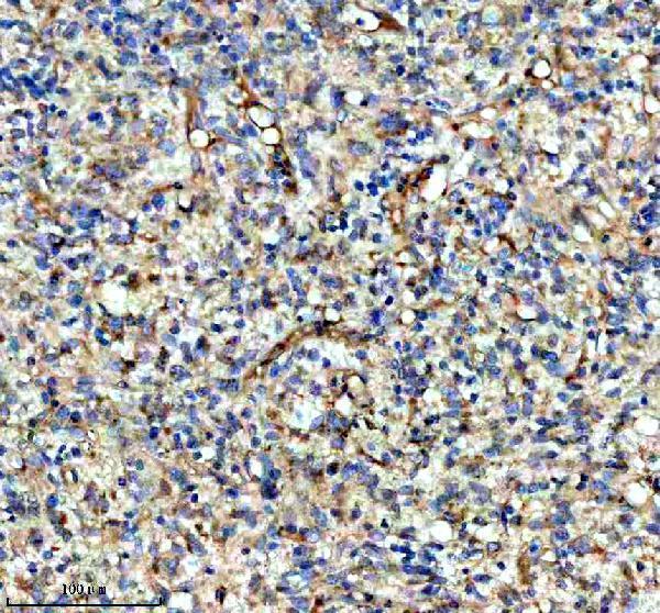 IHC analysis of KCNA6 using anti-KCNA6 antibody (A11084-1)