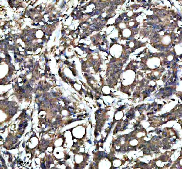 a11084 1 kcna6 primary antibodies ihc testing 5