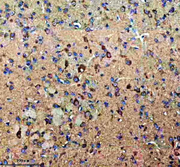 a11084 1 kcna6 primary antibodies ihc testing 6