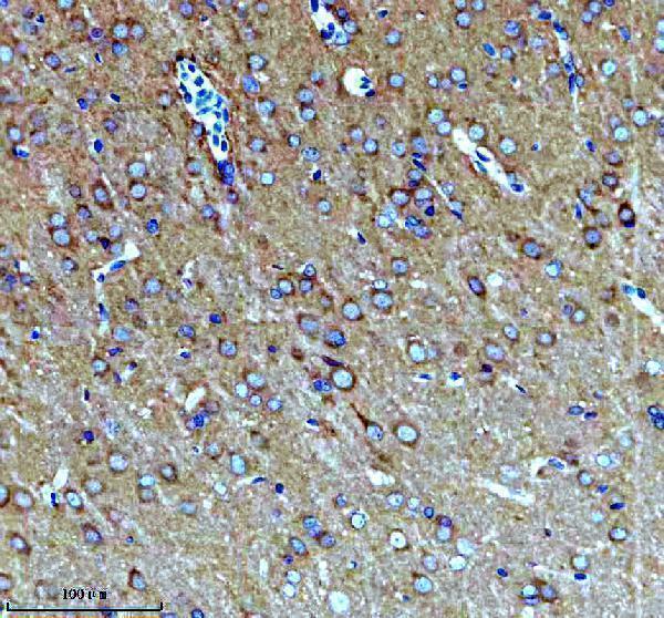 a11084 1 kcna6 primary antibodies ihc testing 7