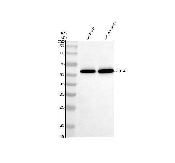 Western blot analysis of KCNA6 using anti-KCNA6 antibody (A11084-1)