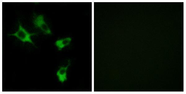 a11085 1 mast4 primary antibodies if testing 1