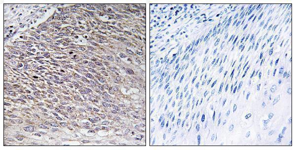 a11085 1 mast4 primary antibodies ihc testing 2