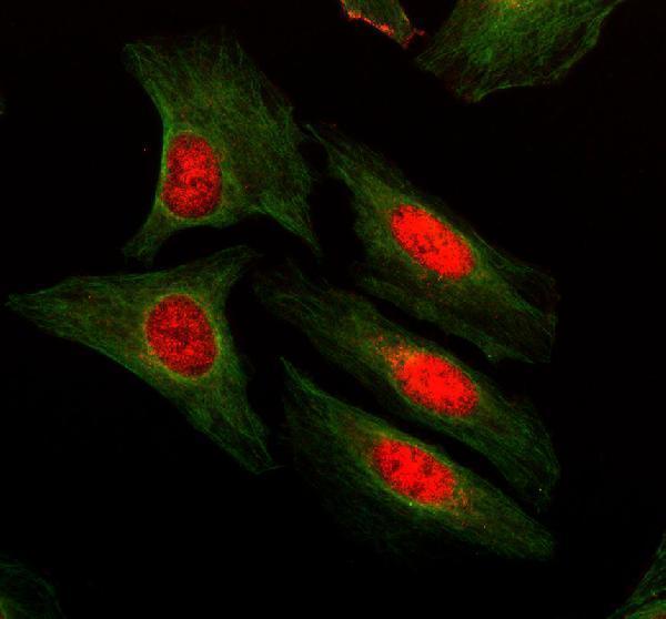 IF analysis of GMF Beta/GMFB using anti-GMF Beta/GMFB antibody (A11087-2) and anti-Alpha Tubulin antibody (M03989-3)