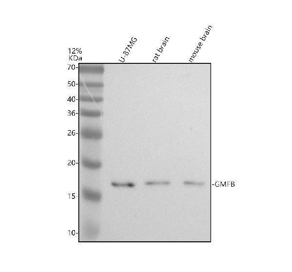 Western blot analysis of GMF Beta/GMFB using anti-GMF Beta/GMFB antibody (A11087-2)
