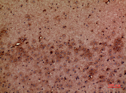 a11087 gmfb primary antibodies ihc testing 1