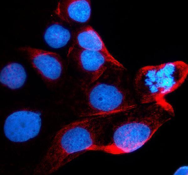 a11089 1 gpr83 primary antibodies if testing 1