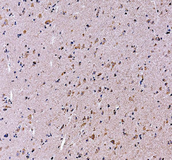 a11089 1 gpr83 primary antibodies ihc testing 1