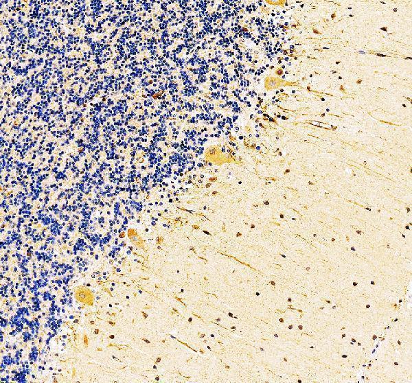 a11089 1 gpr83 primary antibodies ihc testing 2