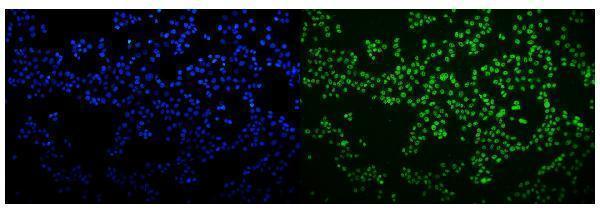 a11090 1 hnrnpn3 primary antibodies if testing 9