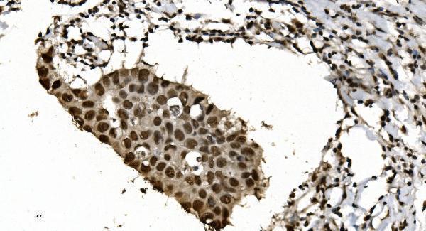  IHC analysis of HNRNPH3 using anti-HNRNPH3 antibody (A11090-1)