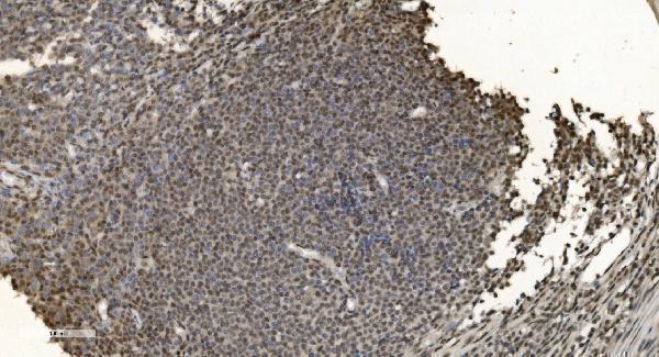  IHC analysis of HNRNPH3 using anti-HNRNPH3 antibody (A11090-1)